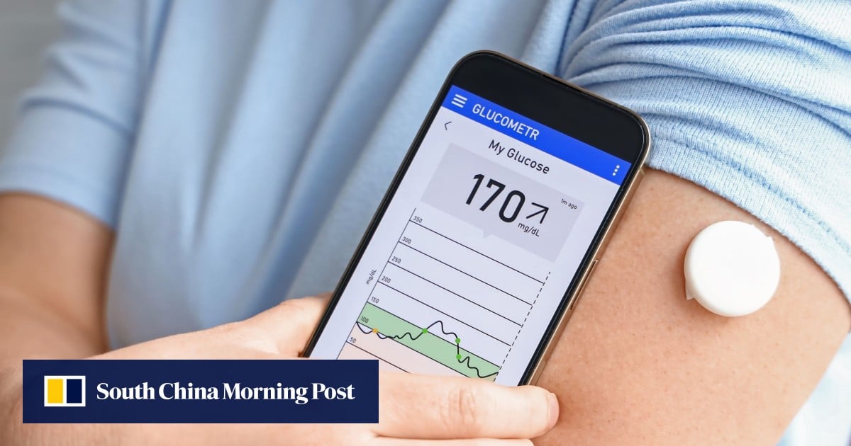 A woman checking her wearable glucose monitor, showcasing the latest in health technology aimed at optimizing wellness through continuous feedback.